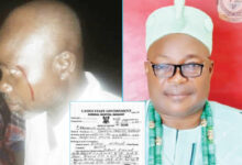 Lagos monarch punches chief, victim demands justice